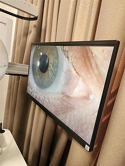 Blick ins Auge in Echtzeit Detailaufnahme eines Auges auf einem Monitor während einer Untersuchung.